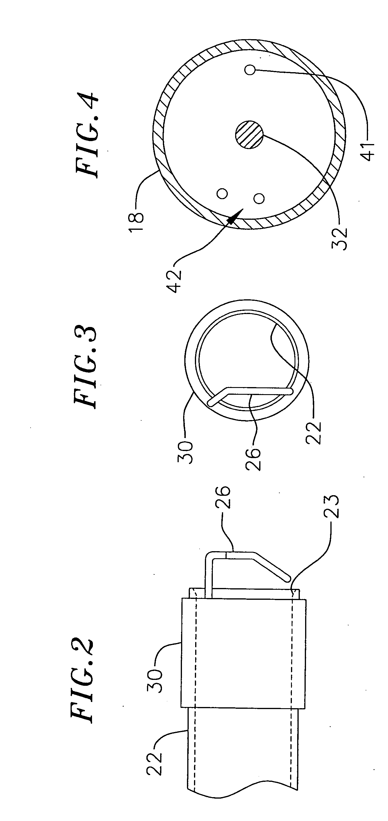 Loop structures for positioning a diagnostic or therapeutic element on the epicardium or other organ surface