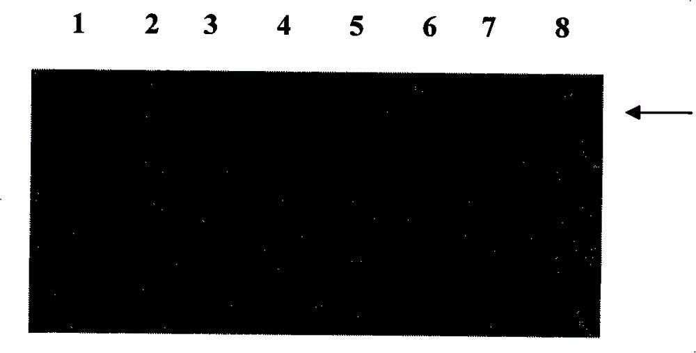 Surface protein of streptococcus suis type-2, preparation method thereof and application