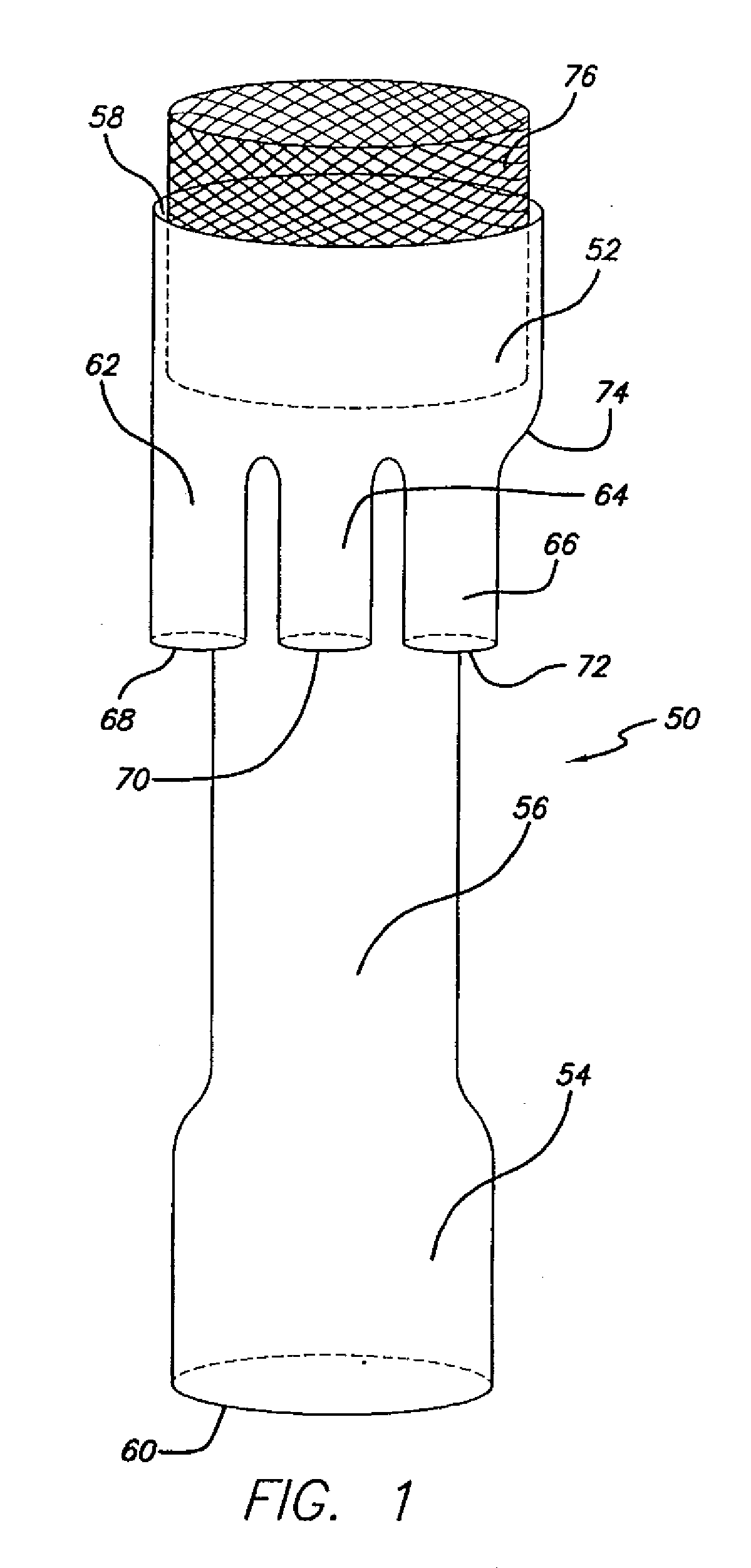 Modular grafting system and method