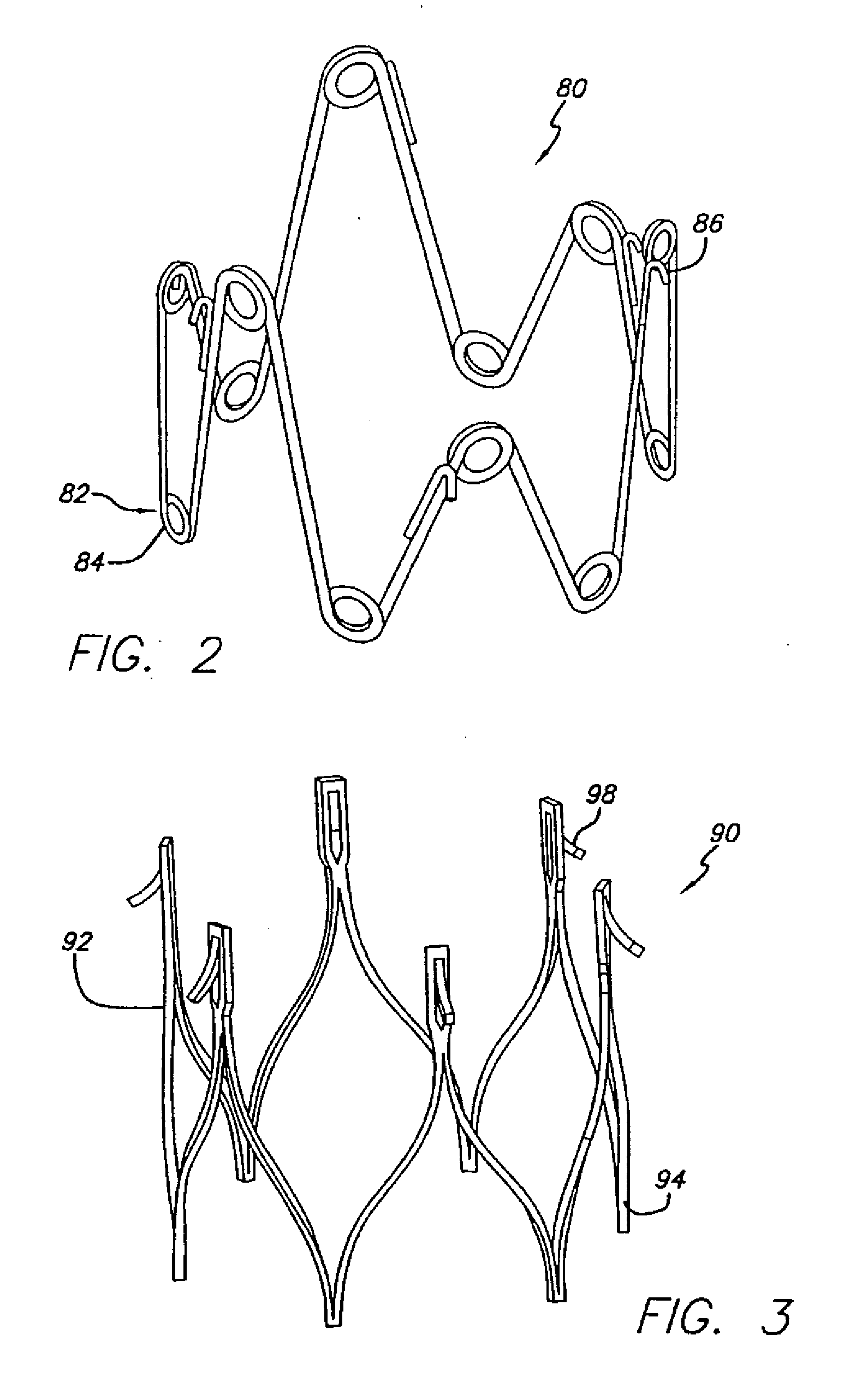 Modular grafting system and method