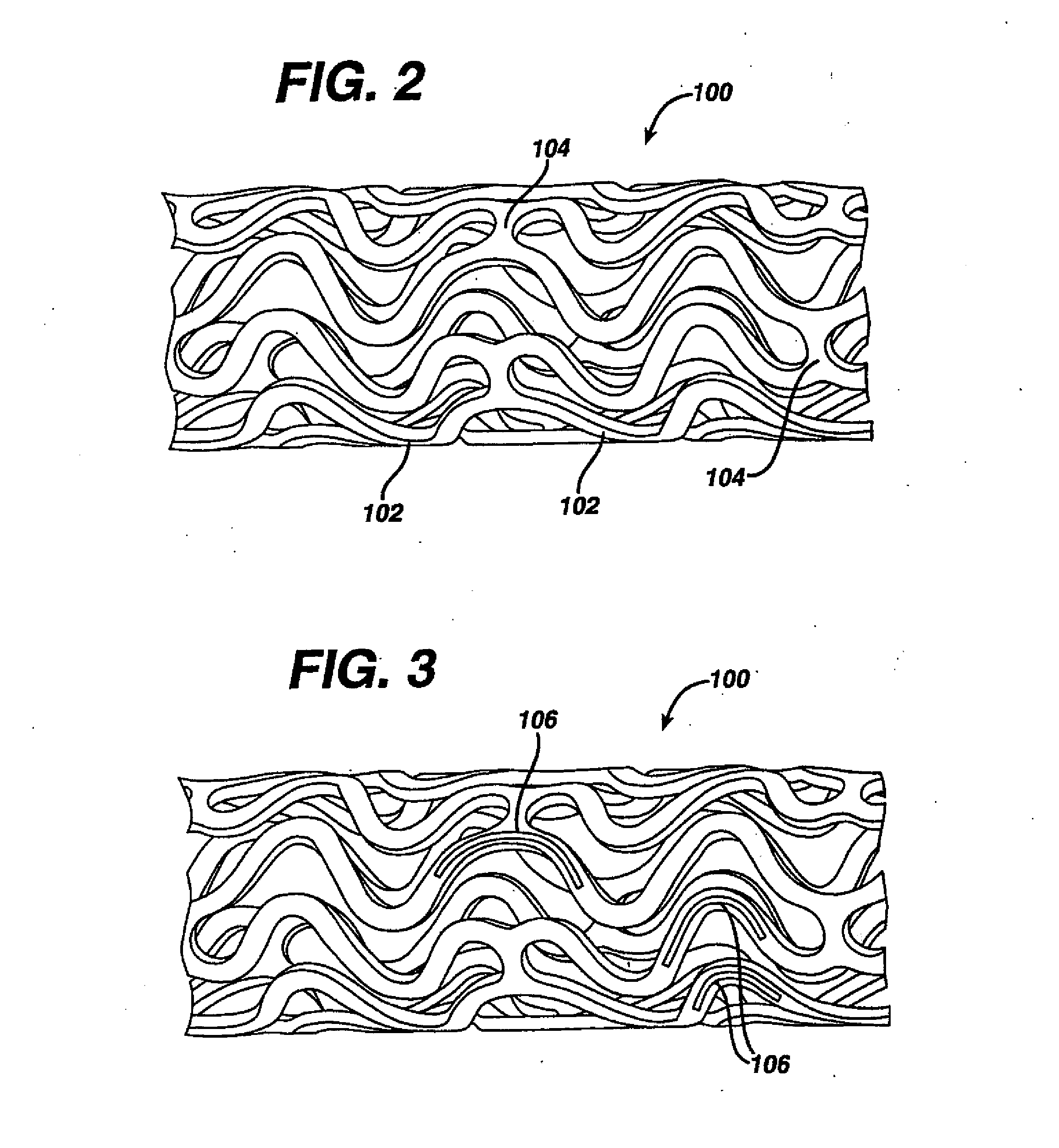 Drug/Drug Delivery Systems for the Prevention and Treatment of Vascular Disease