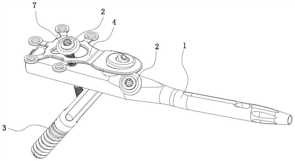 Proximal femoral intramedullary nail system