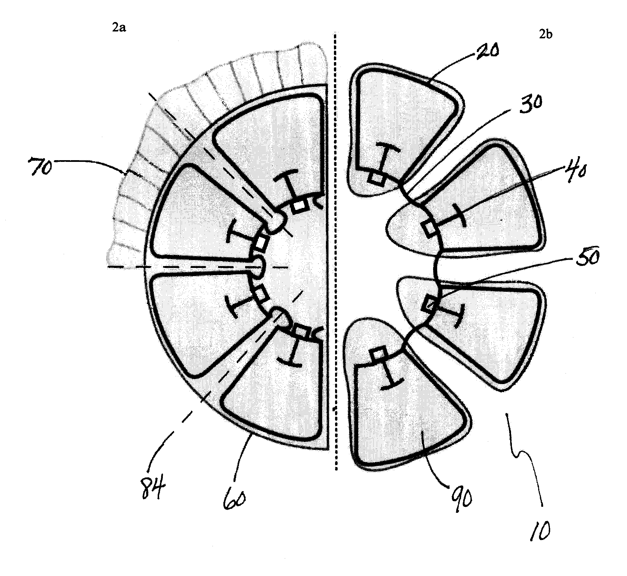 Accommodative intraocular lens and method of improving accommodation