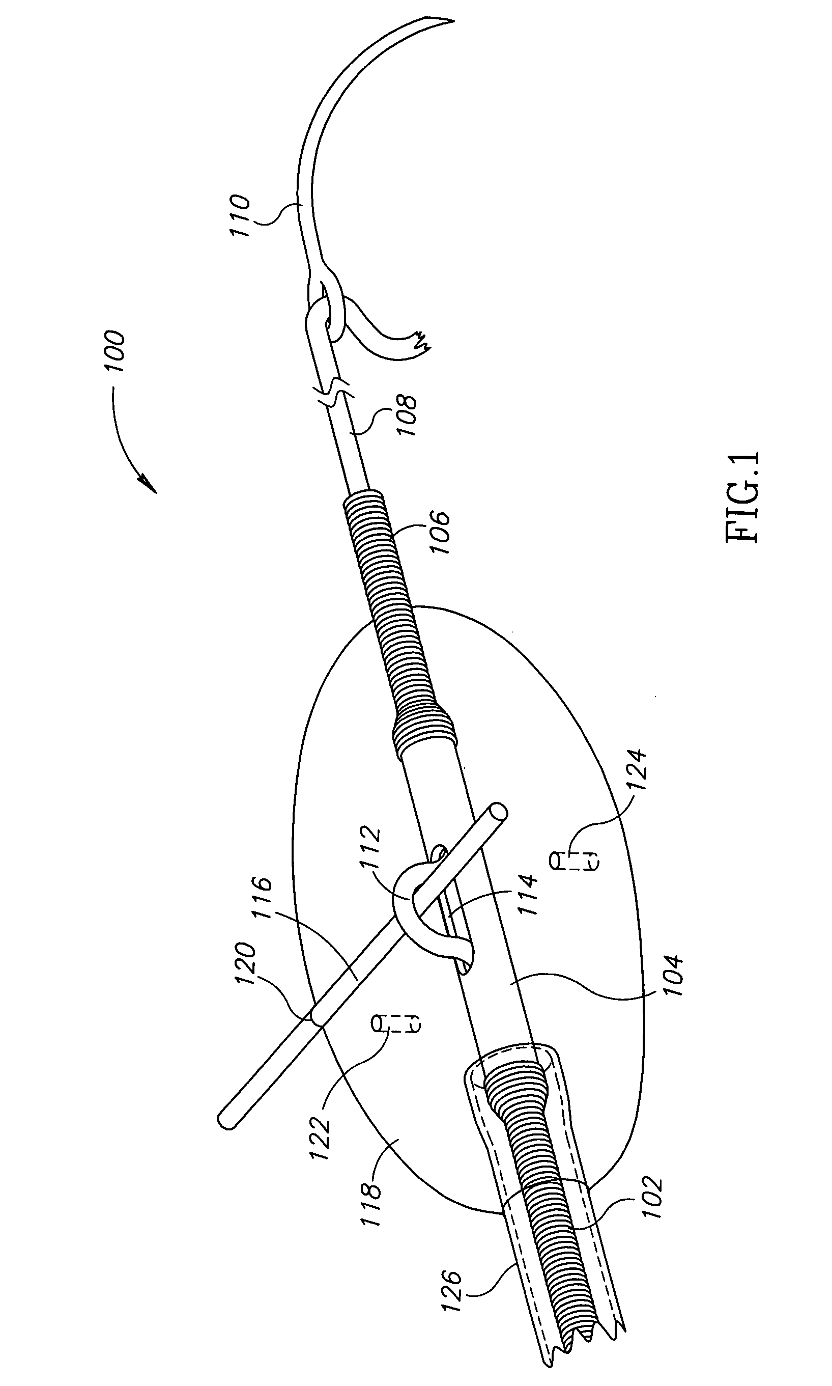 Pancreas lead