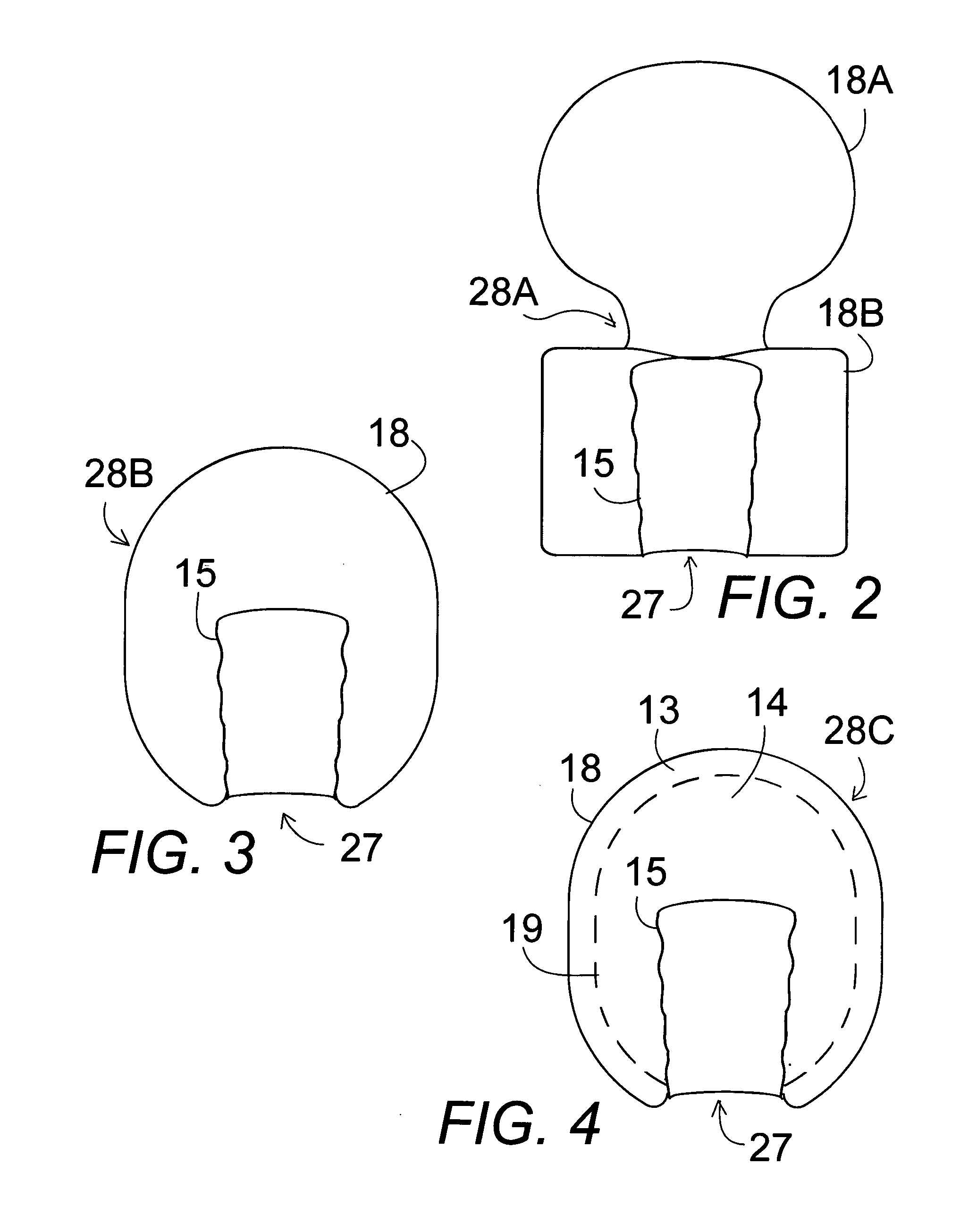 Childbirth inflatable water/air vaginal obturator