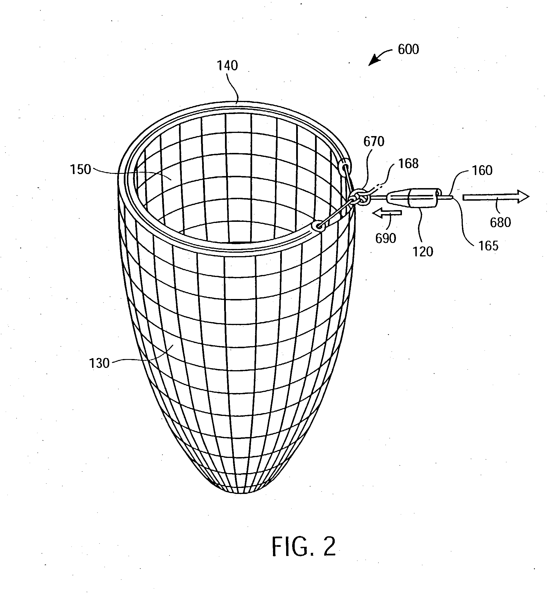 Method for cardiac restaint