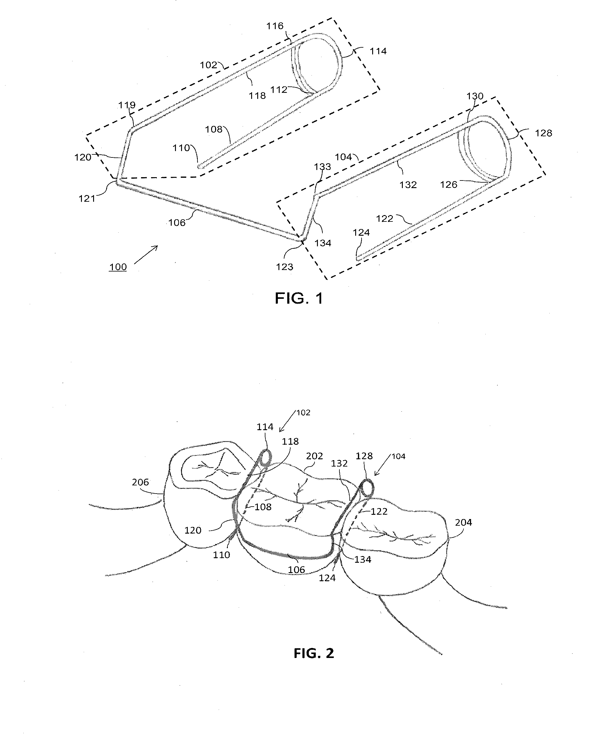 Orthodontic separator