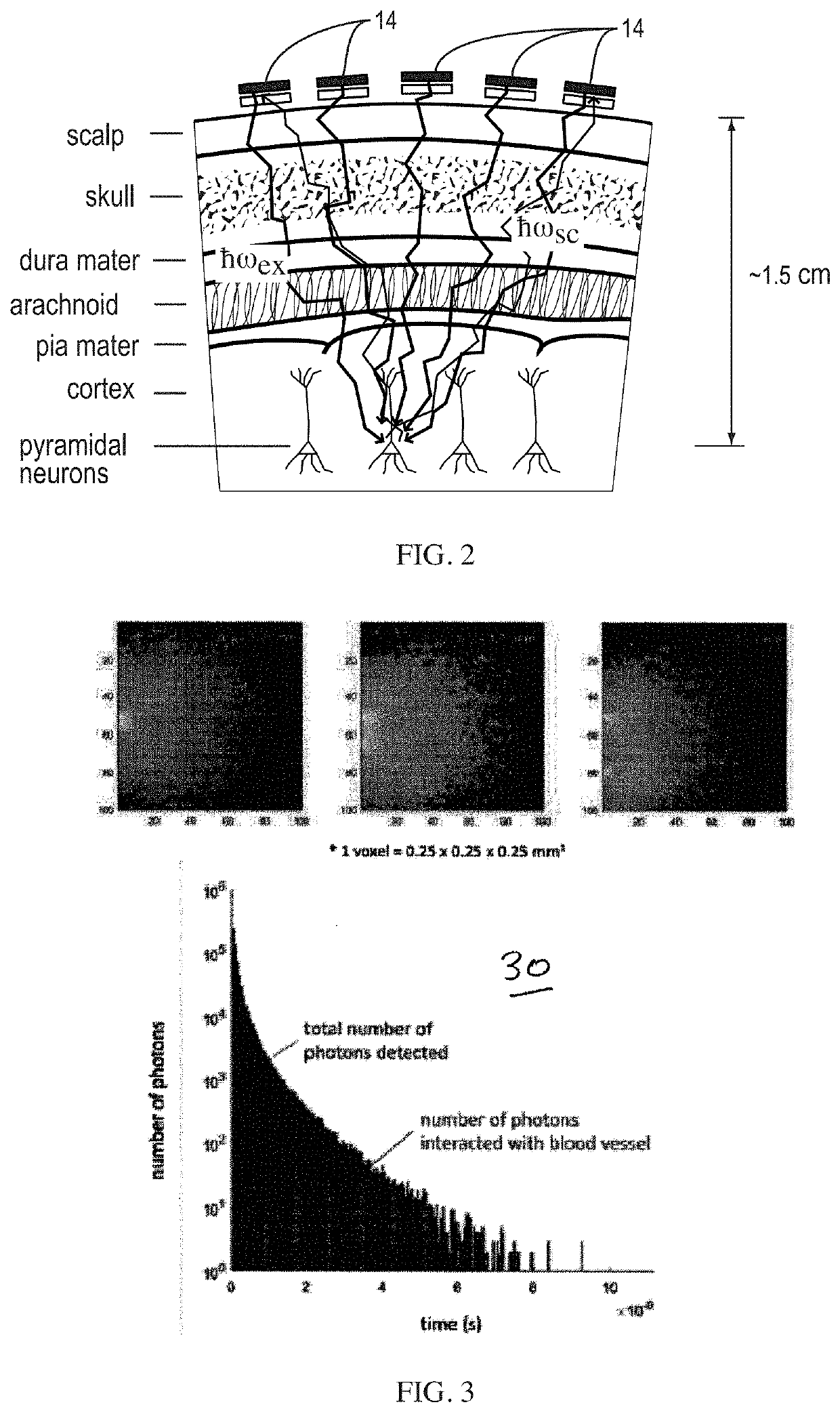 High spatiotemporal resolution brain imaging