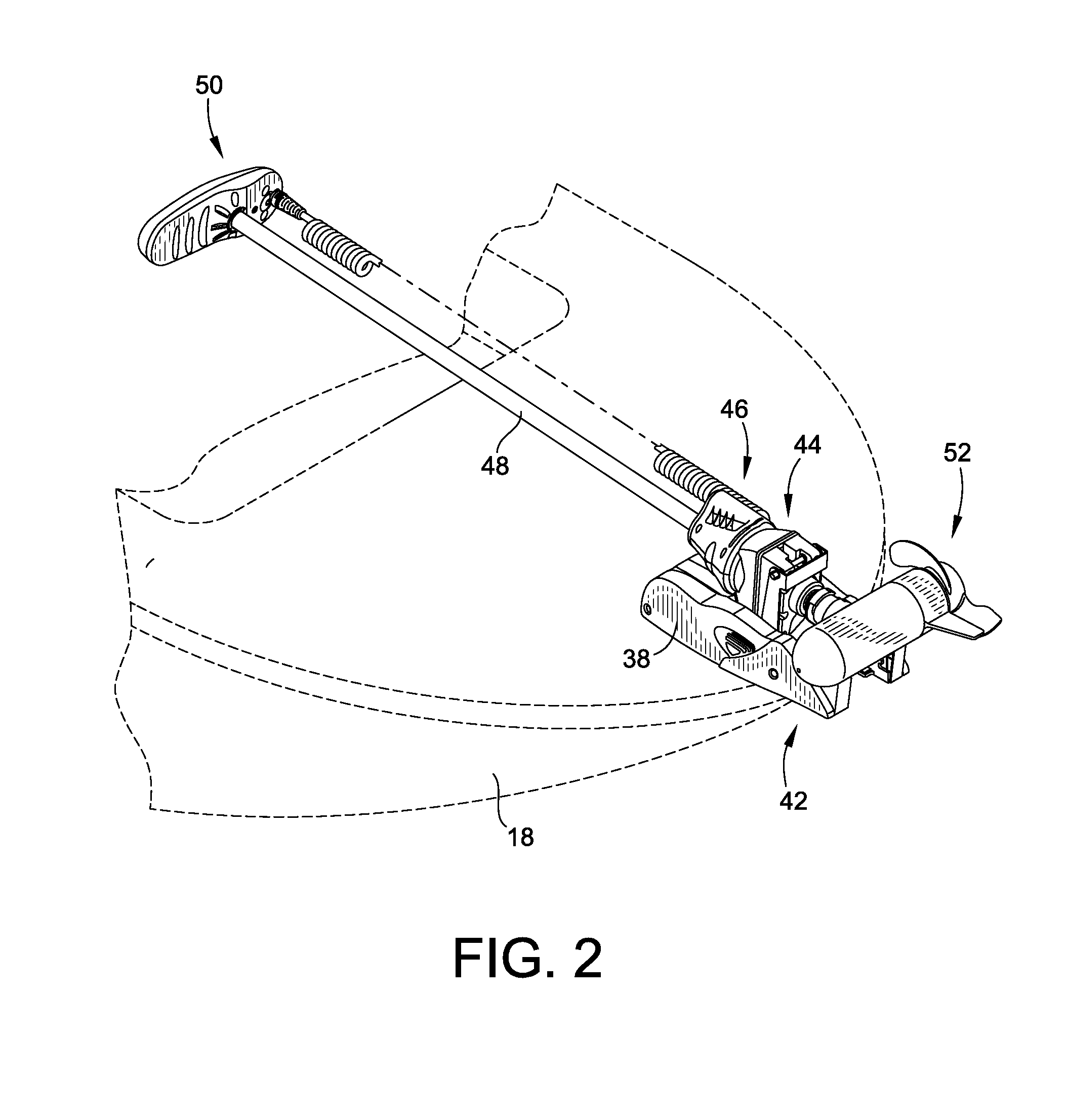 Trolling Motor