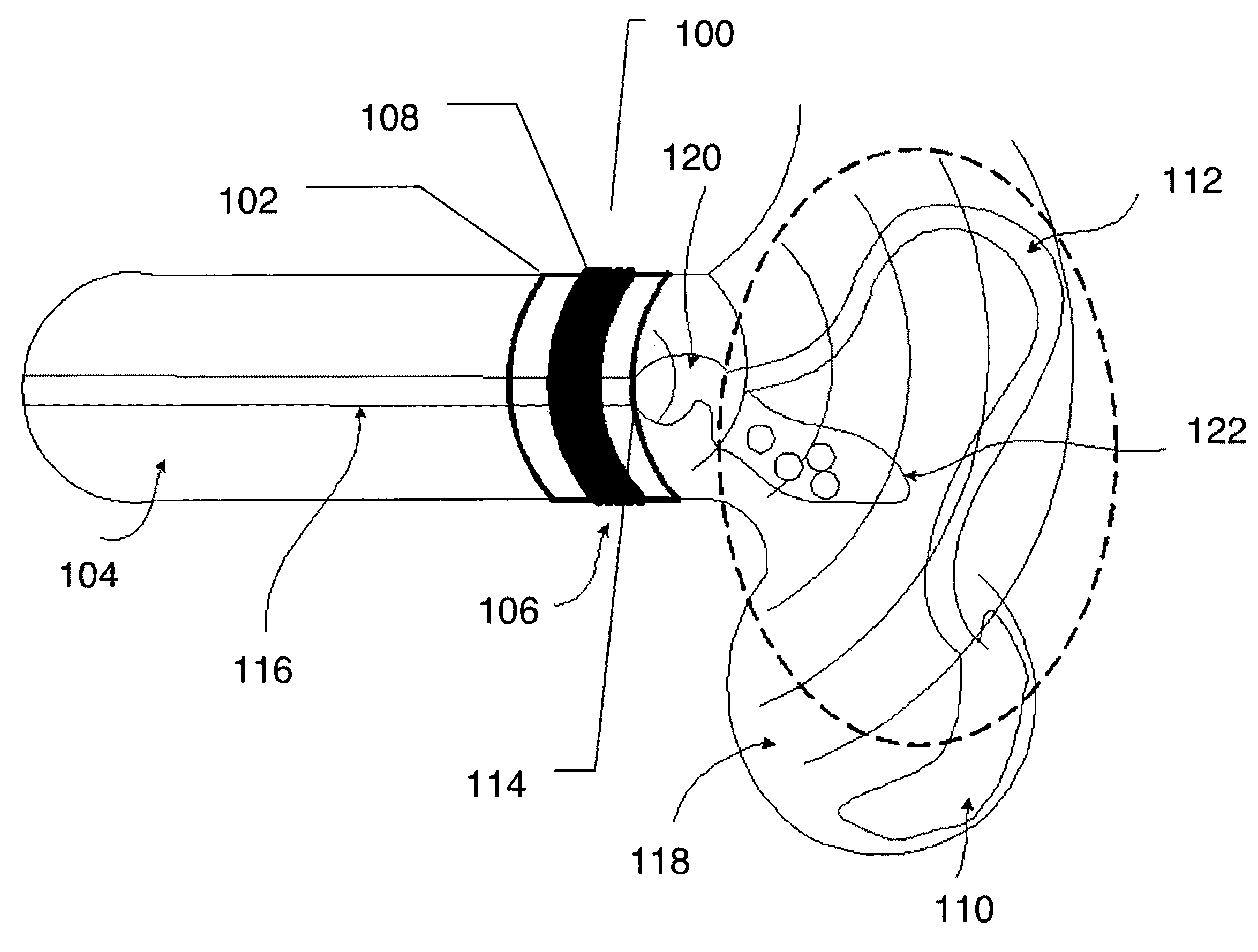 Ultrasonic device for fertility control and management and navigation