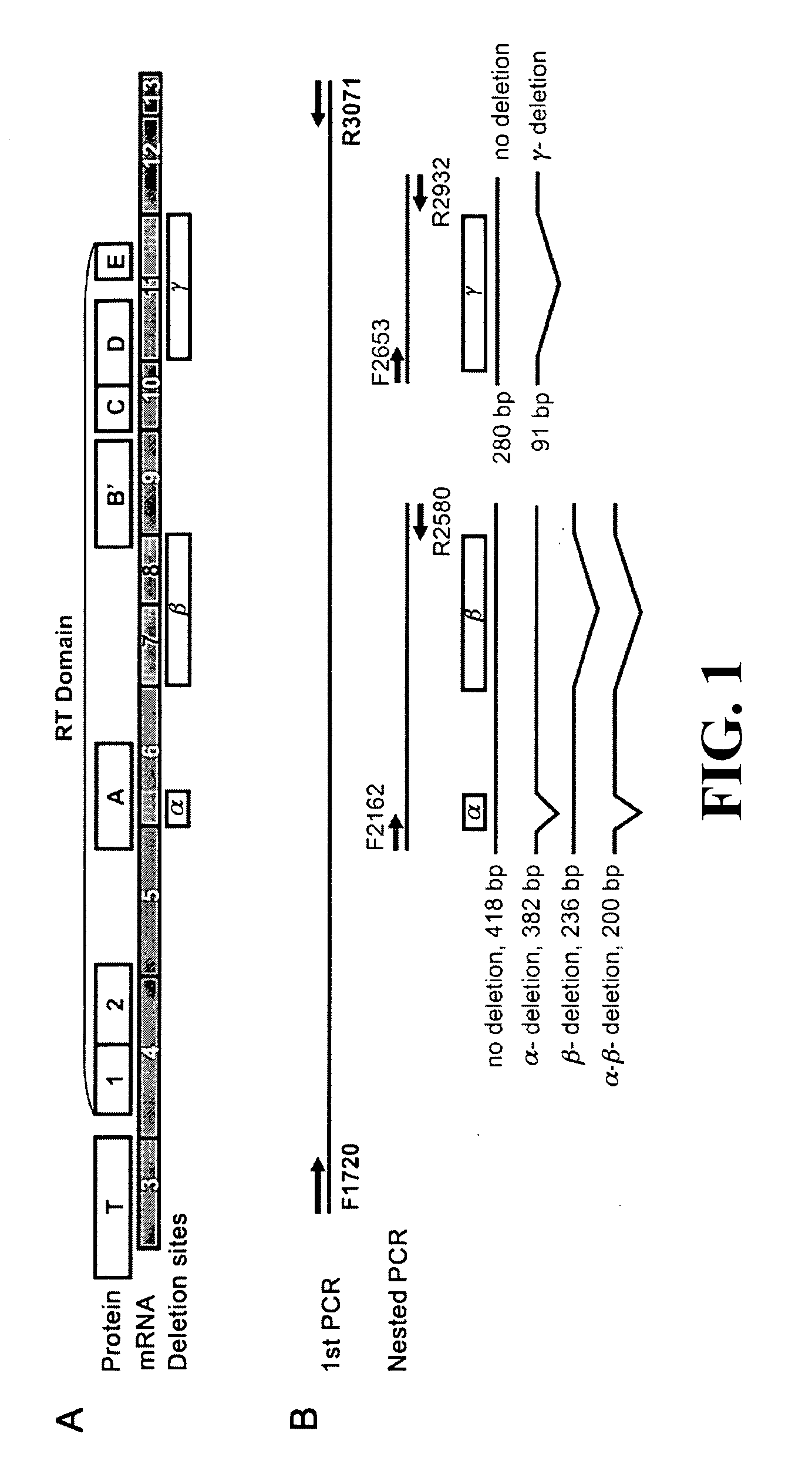 ALTERNATIVE SPLICE VARIANT PATTERNS OF HUMAN TELOMERASE REVERSE TRANSCRIPTASE (hTERT) IN THYROID TUMORS TO DISTINGUISH BENIGN FROM MALIGNANT