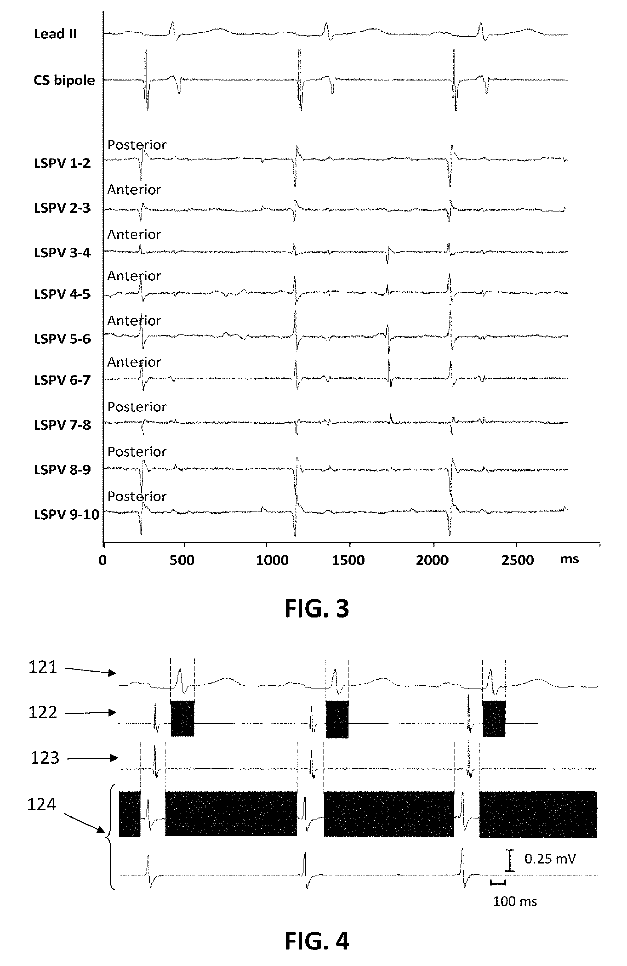 Detection of pulmonary vein isolation