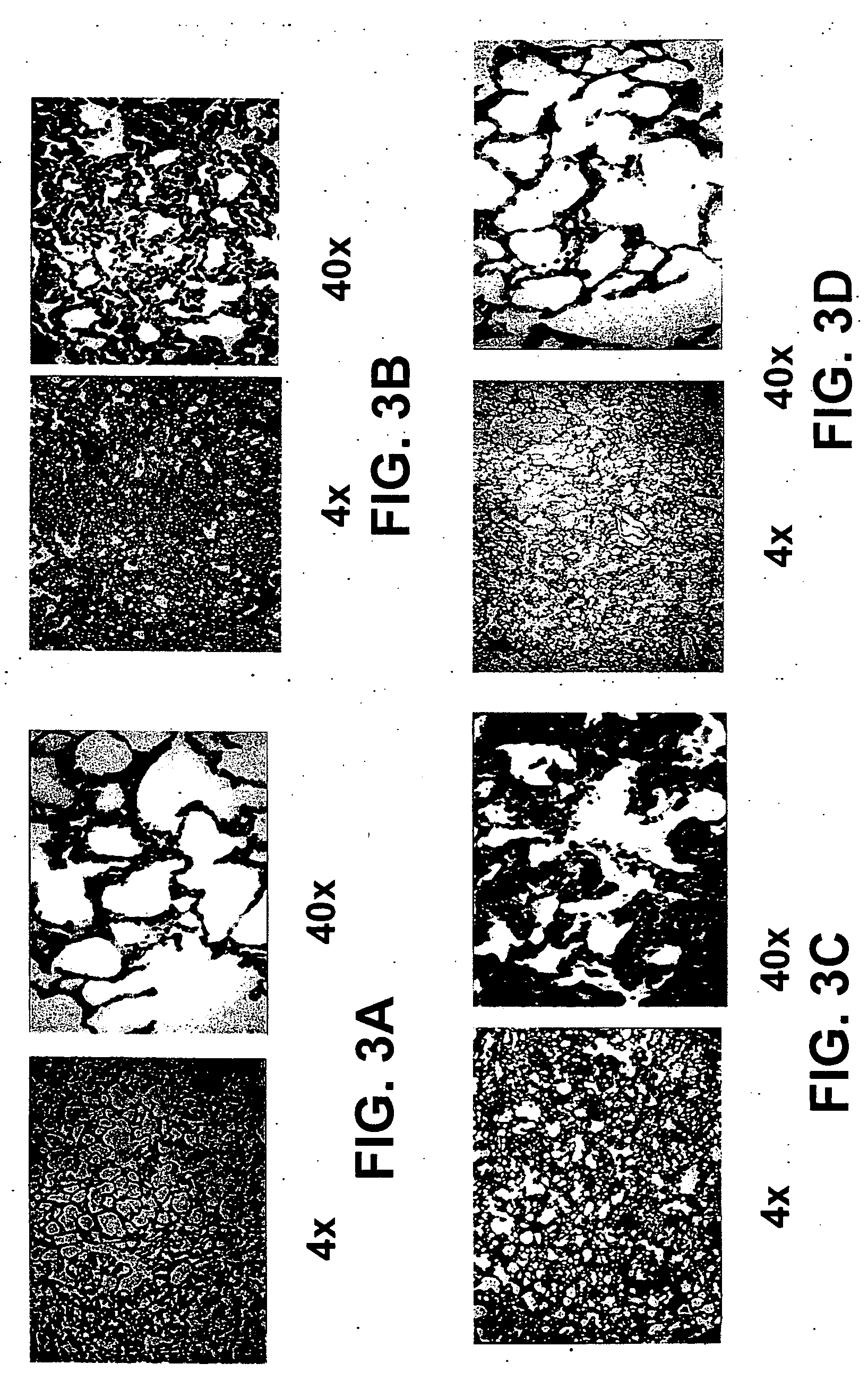 Albumin-based colloid composition and method of use in treating hypovolemia and multiorgan dysfunction