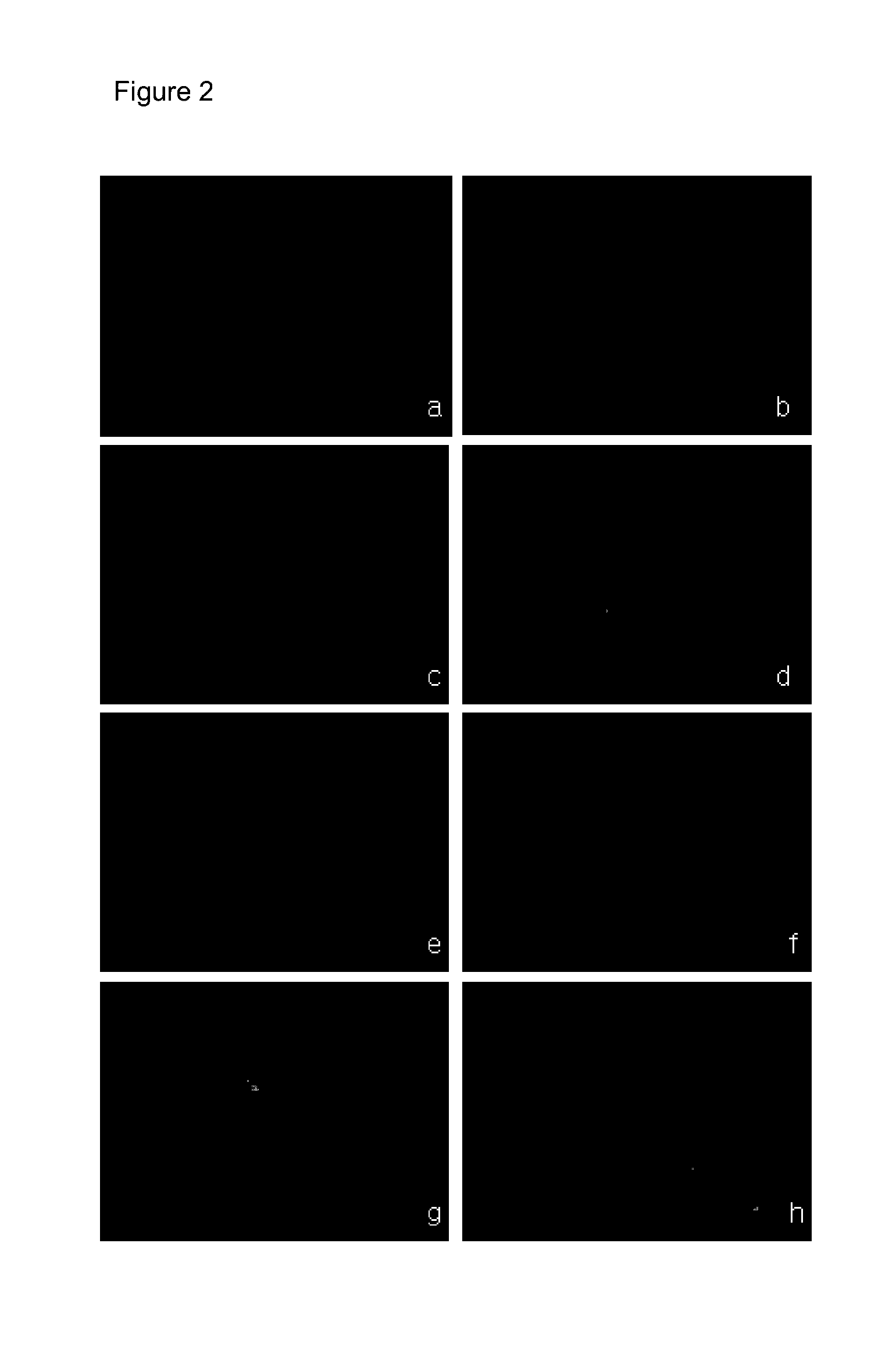 Composition for skin improvement comprising hexamidines and retinoids