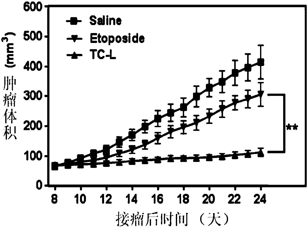 Multicomponent lipid complex system with controlled particle size and drug release by tumor microenvironment, its preparation method and application