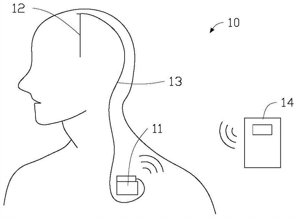 An implantable neurostimulation system