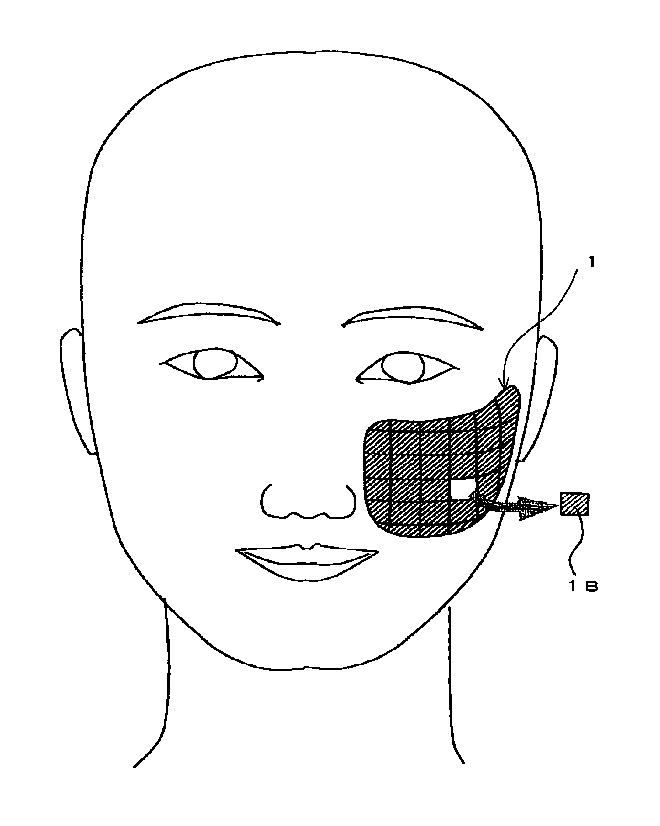 Bandage pad for chemical peels