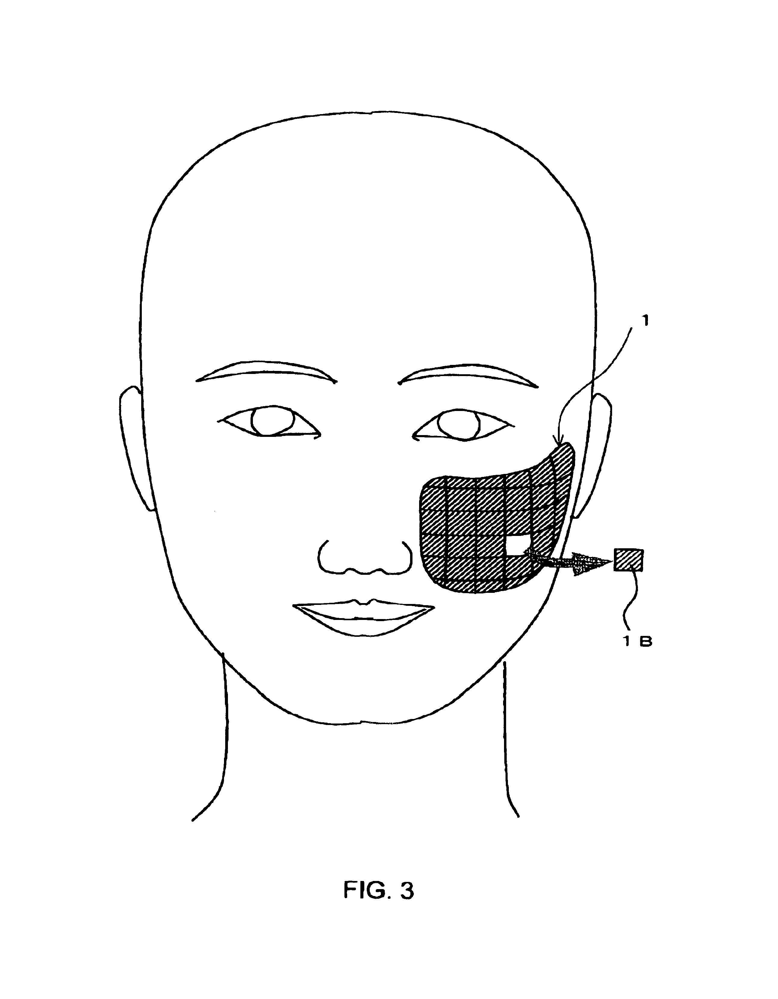 Bandage pad for chemical peels