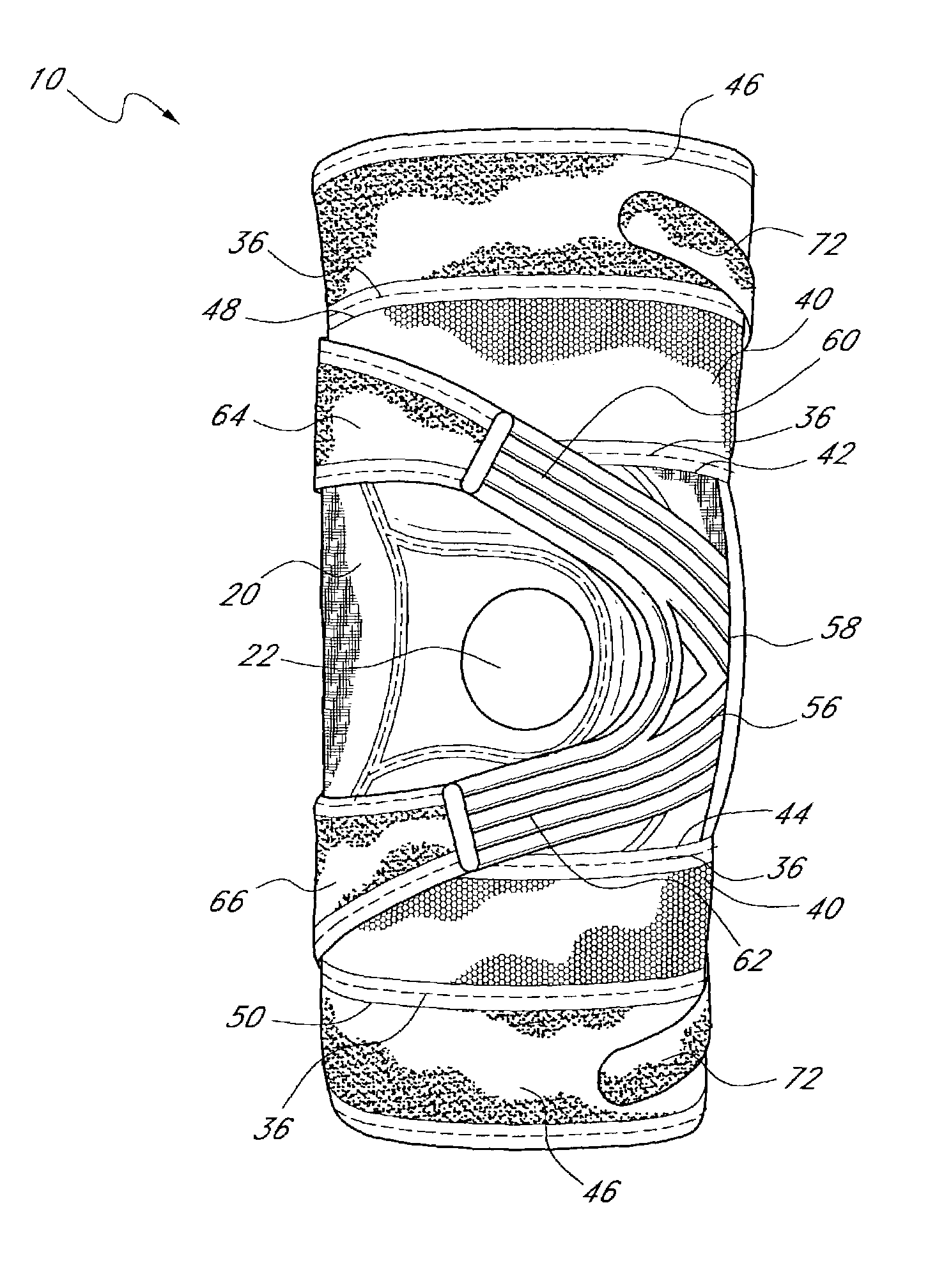 Patellofemoral brace