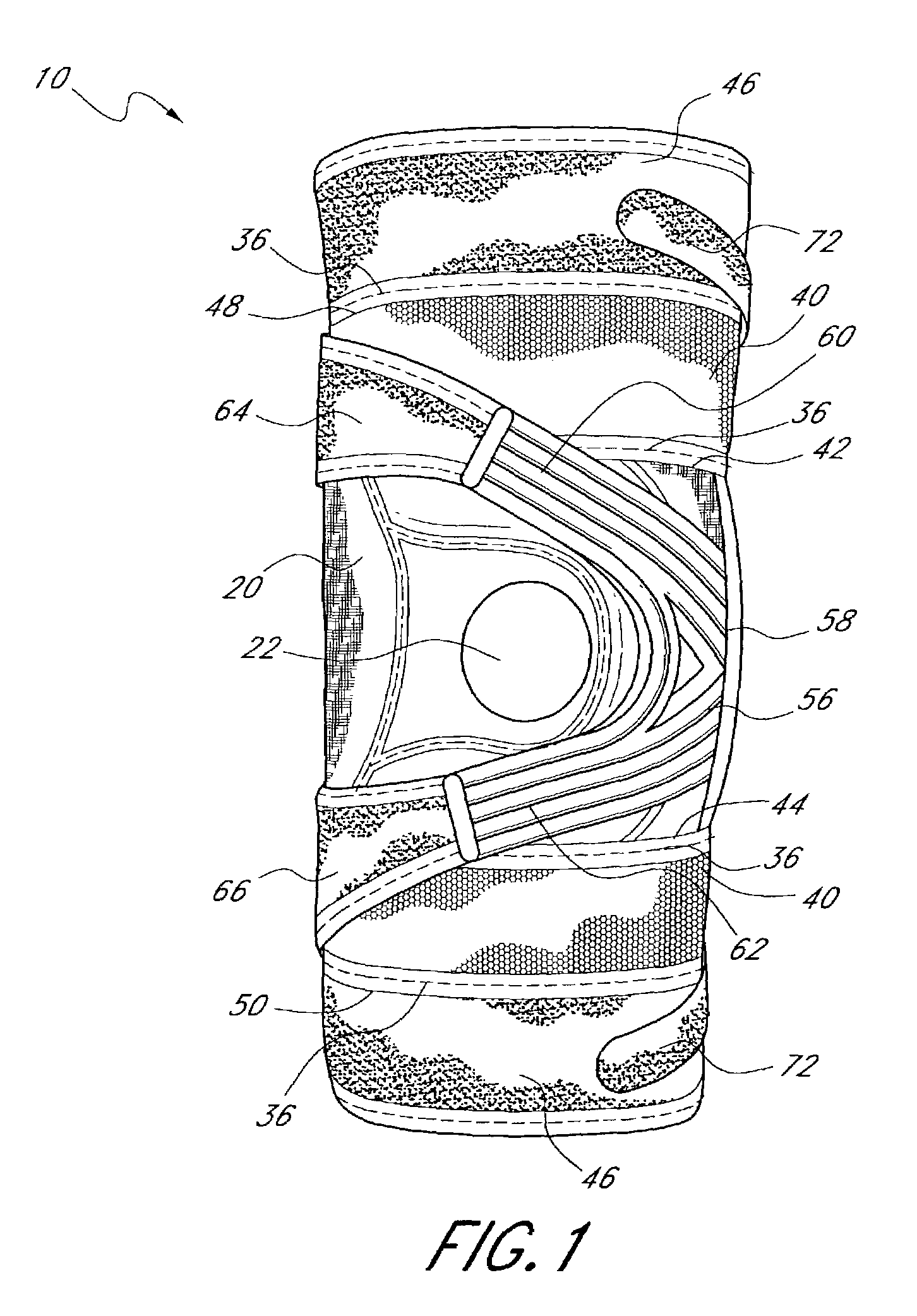 Patellofemoral brace