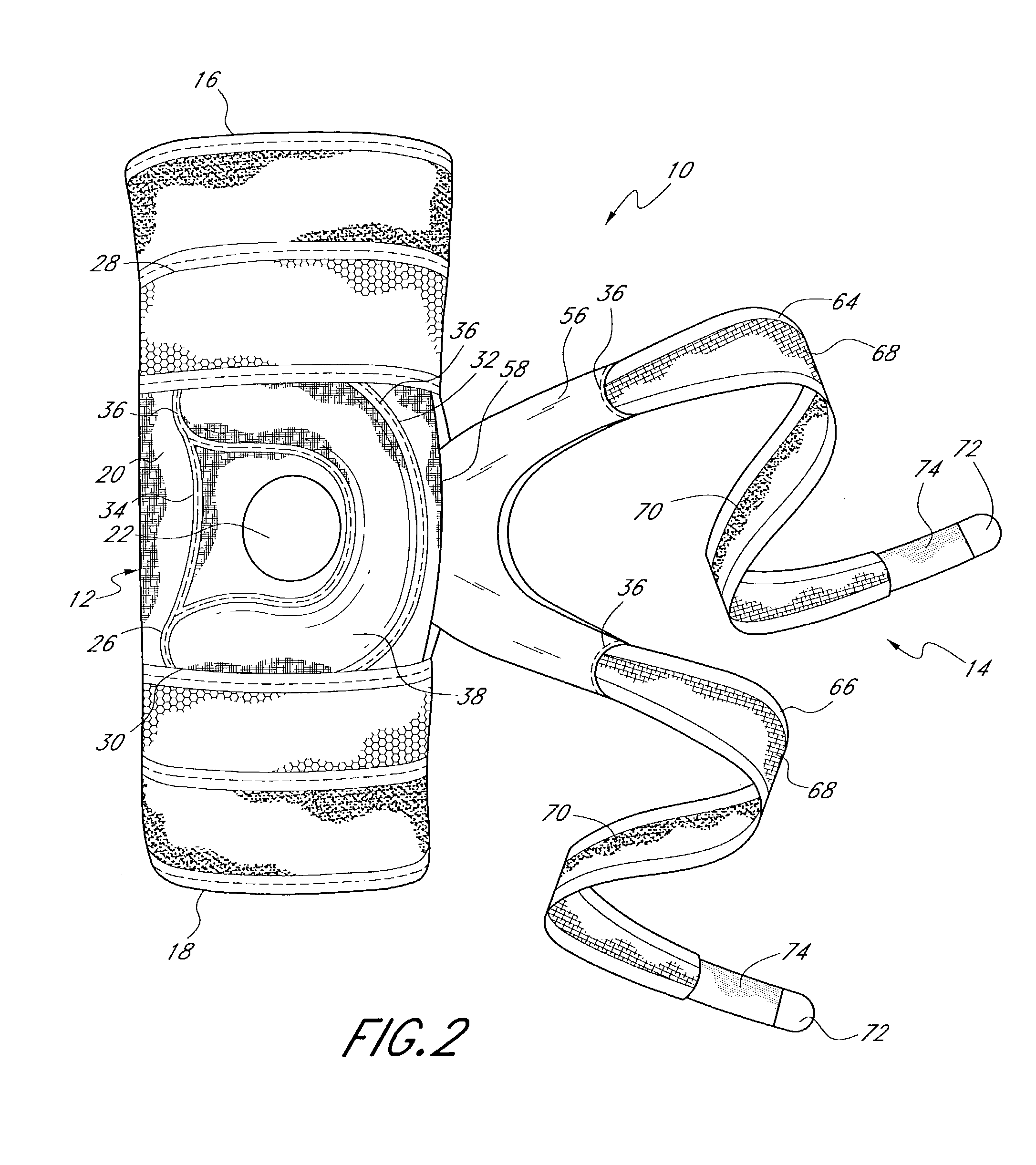 Patellofemoral brace