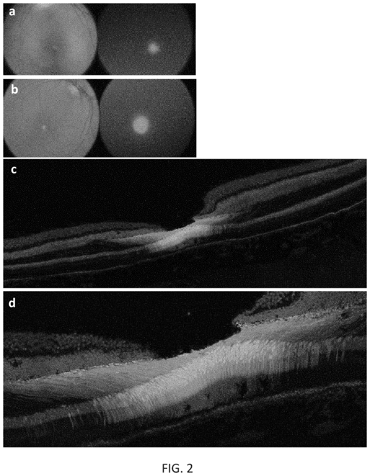 Compositions and methods for intravitreal delivery of polynucleotides to retinal cones