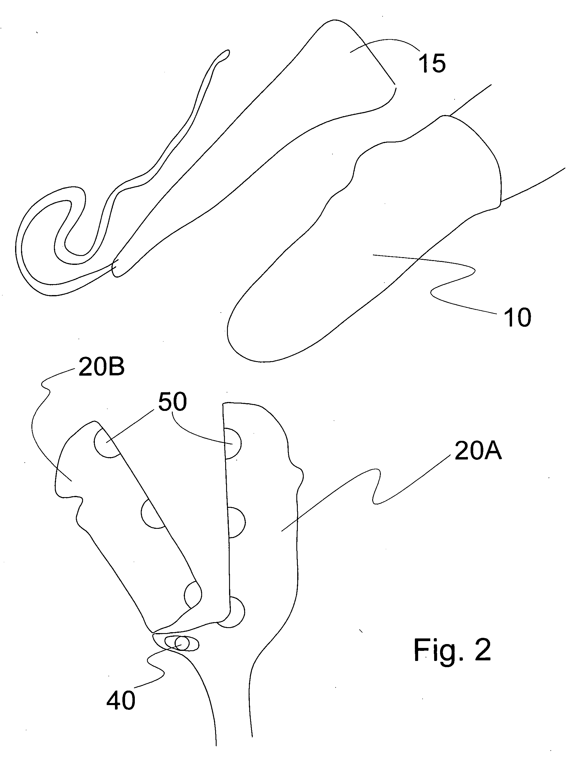 Elastomeric stump sock for suspending by friction an artificial limb