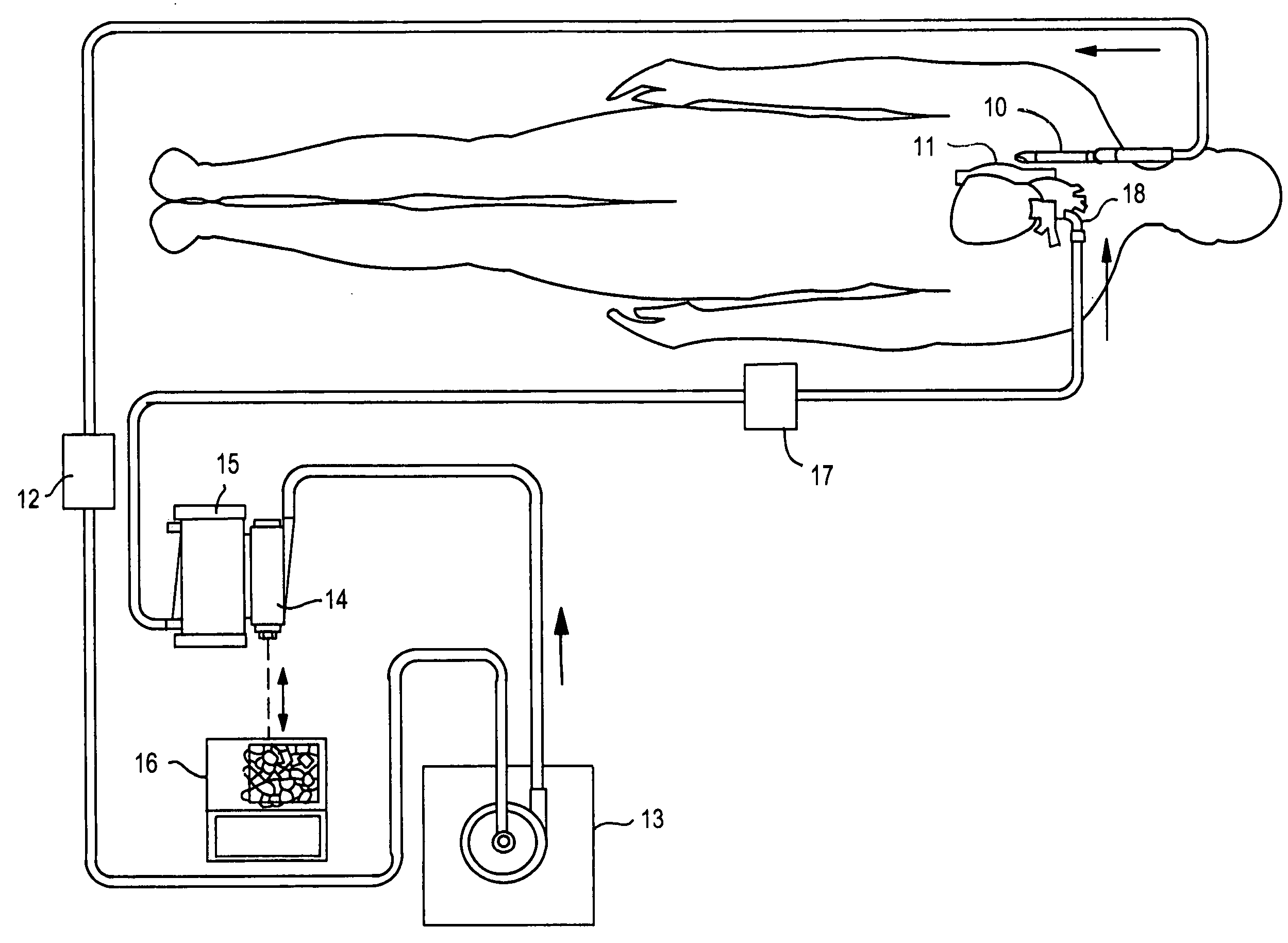 Vortex-flow air removal in a blood perfusion system