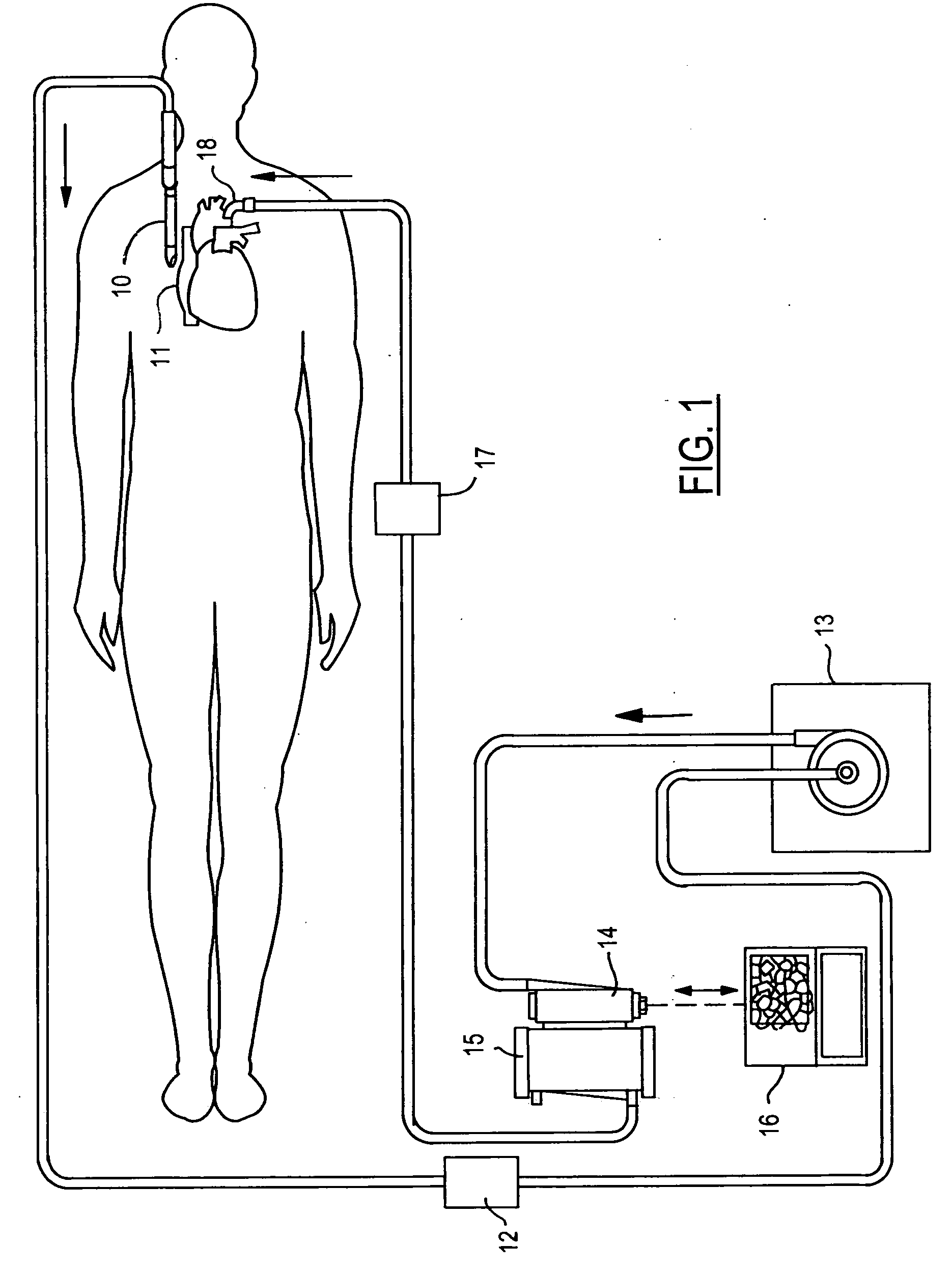 Vortex-flow air removal in a blood perfusion system