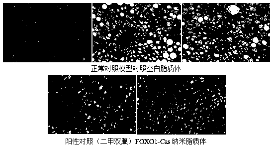 CRISPR-Cas nano drug delivery system specifically targeted to FOXO1 gene and application thereof