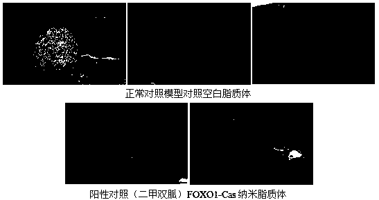 CRISPR-Cas nano drug delivery system specifically targeted to FOXO1 gene and application thereof