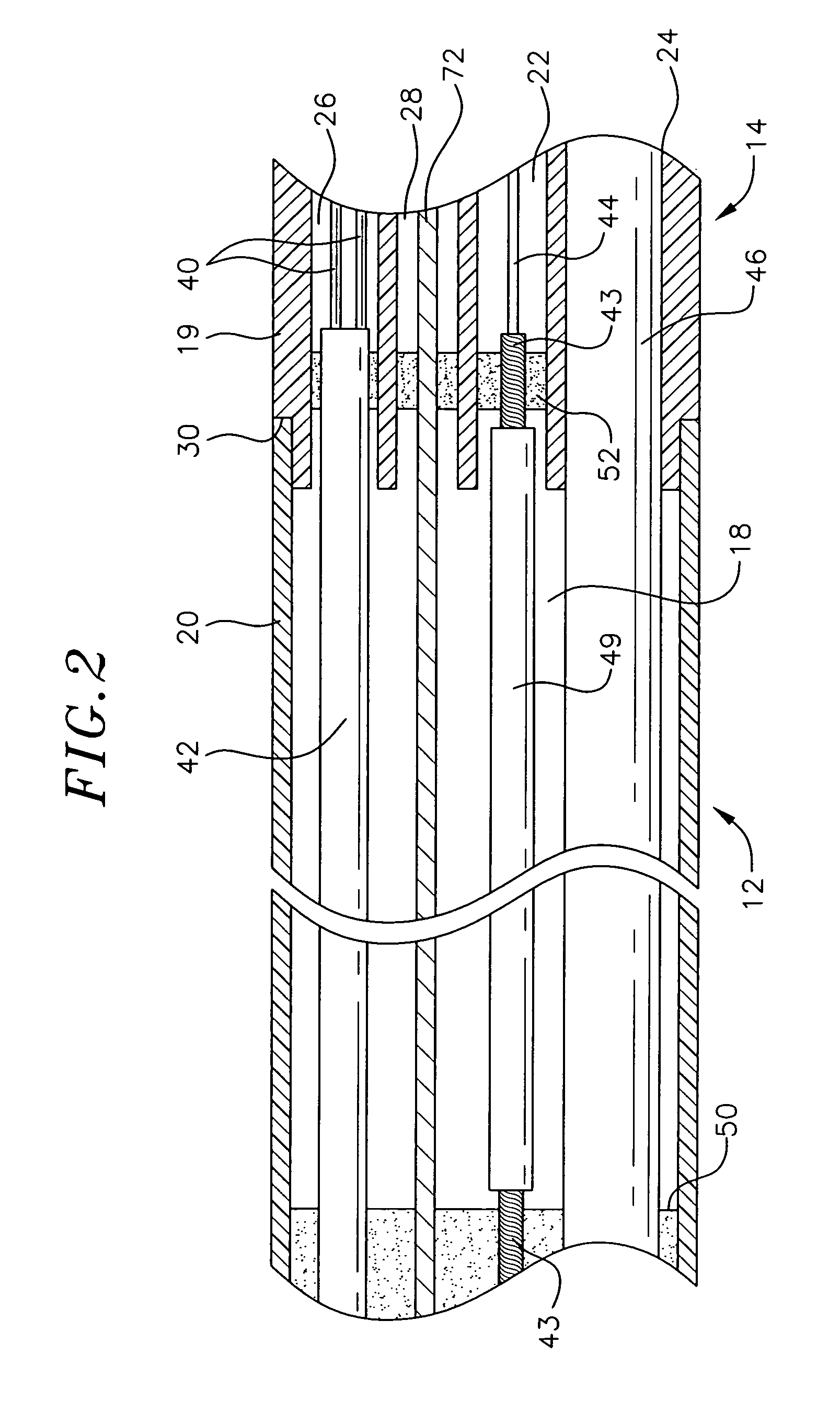 Method for ablating with needle electrode