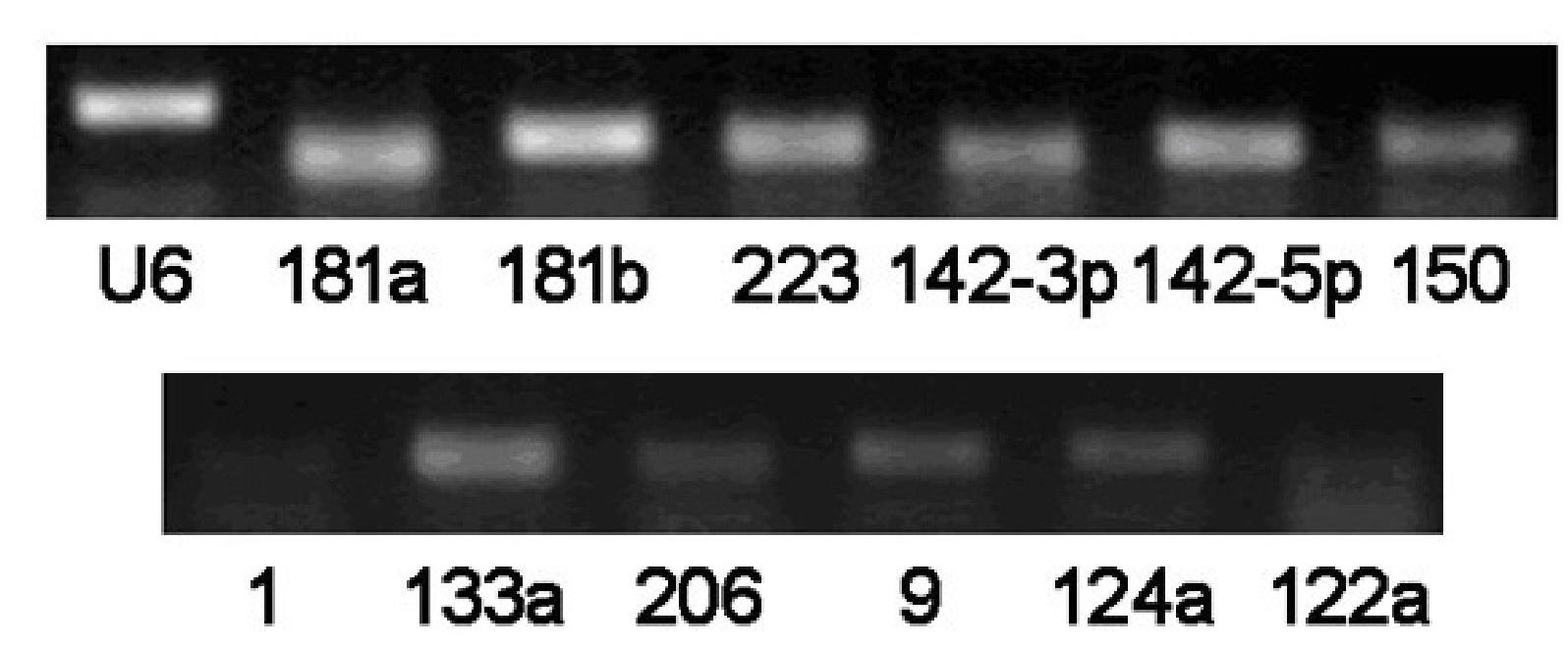 Novel technology for diagnosing liver cancer by utilizing microRNAs in serum