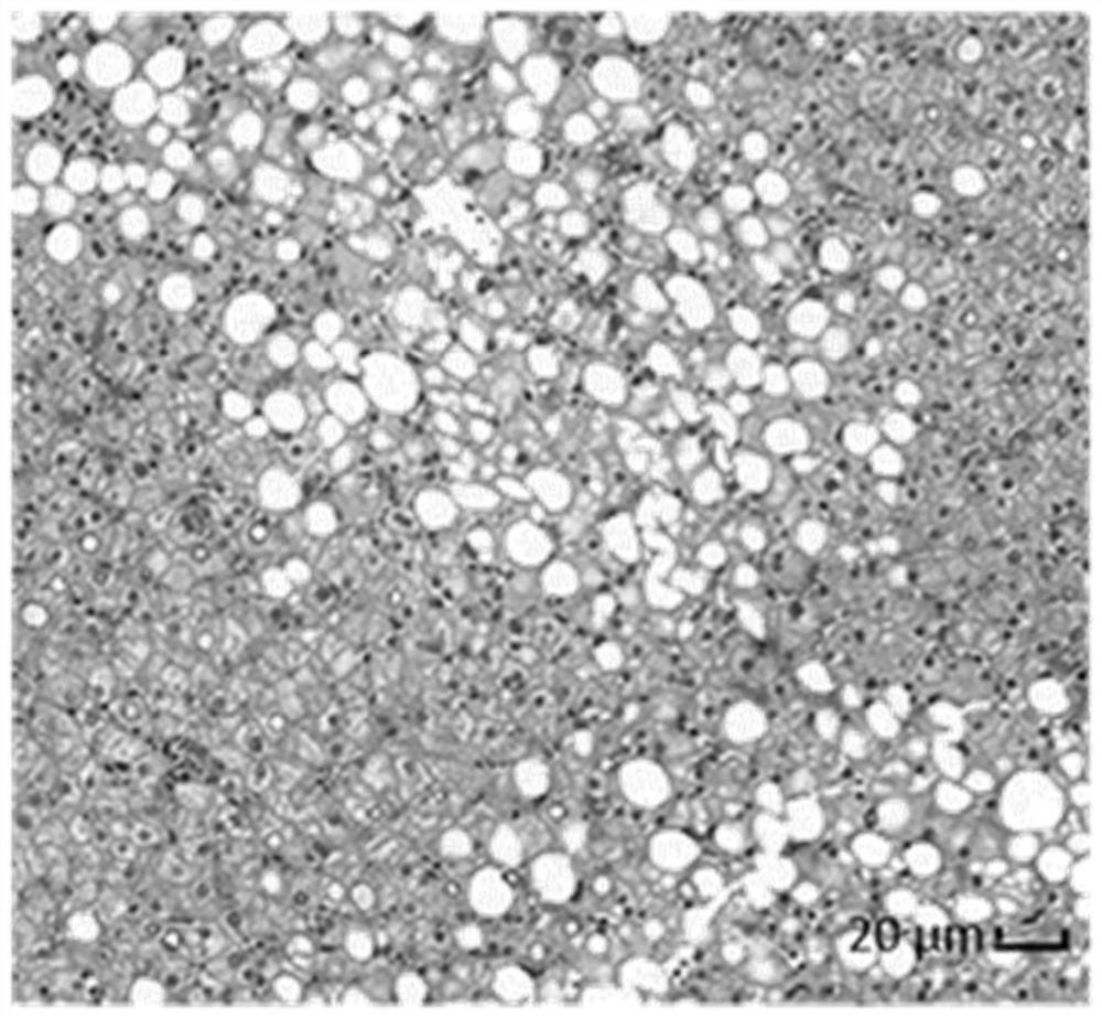 A method for constructing a three-dimensional simulation model of fatty liver tissue