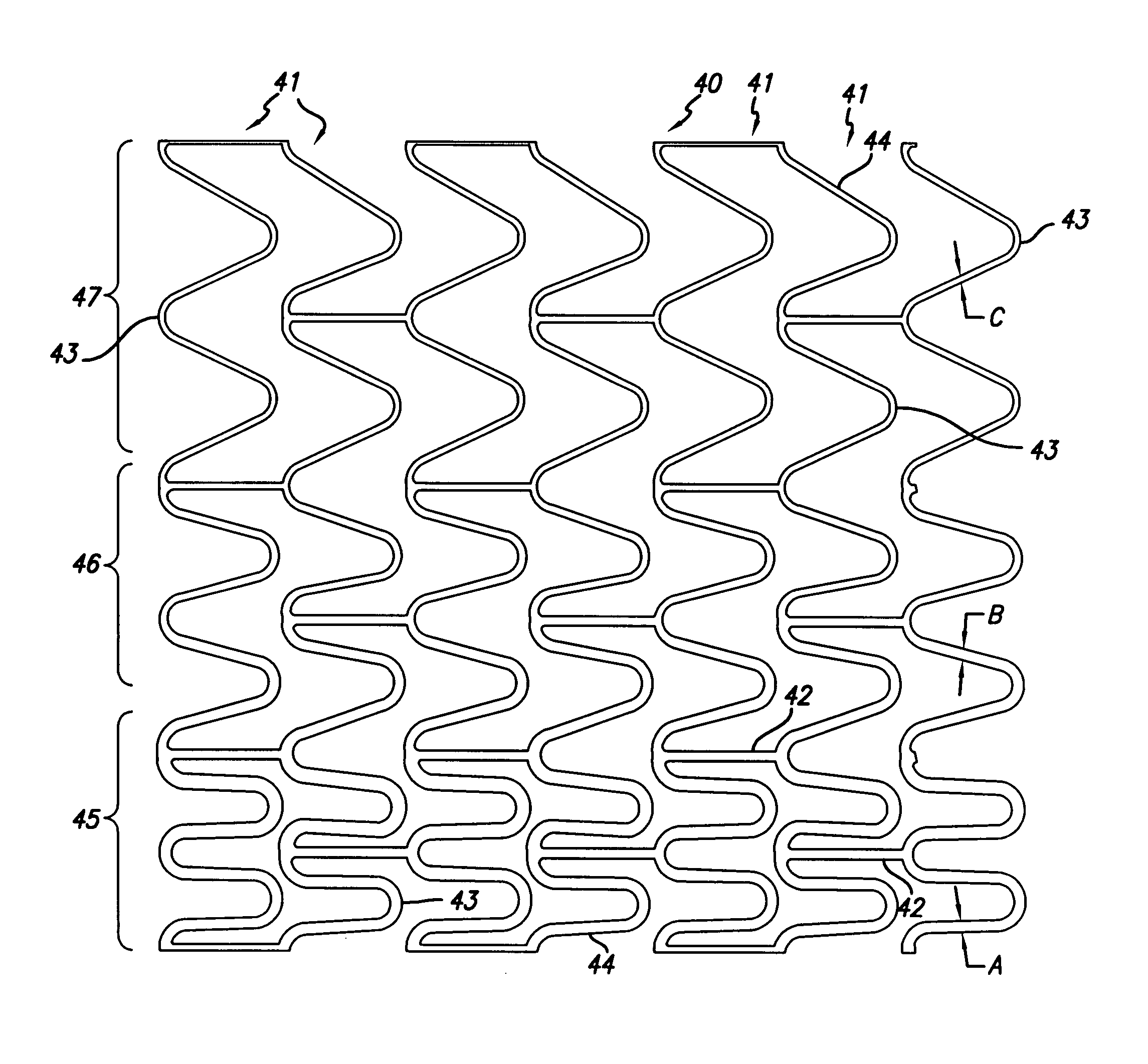 Stent for treating vulnerable plaque