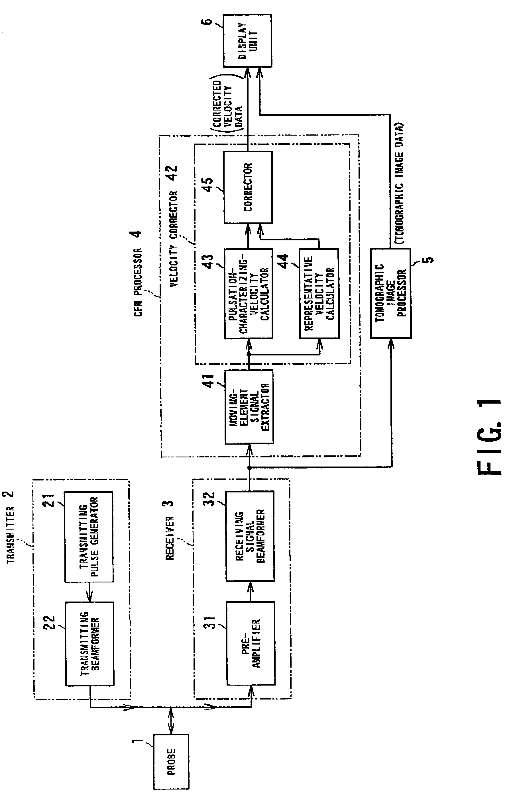 Ultrasonic diagnosis apparatus