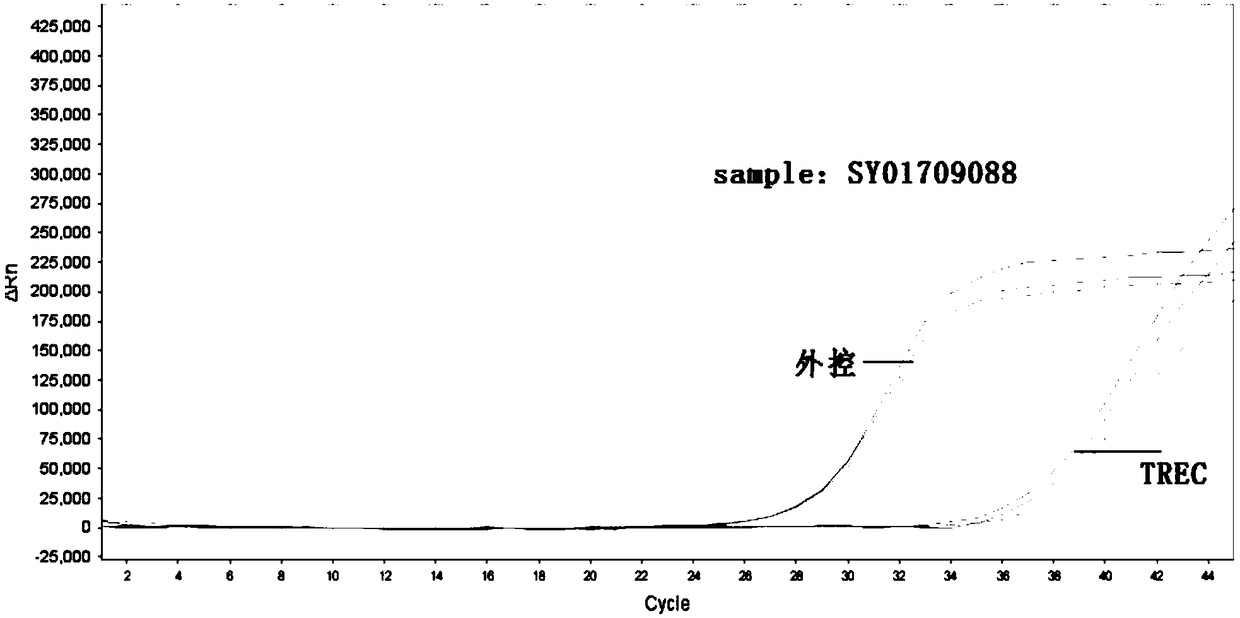 Primer, detection kit and detection method for screening SCID genetic diseases