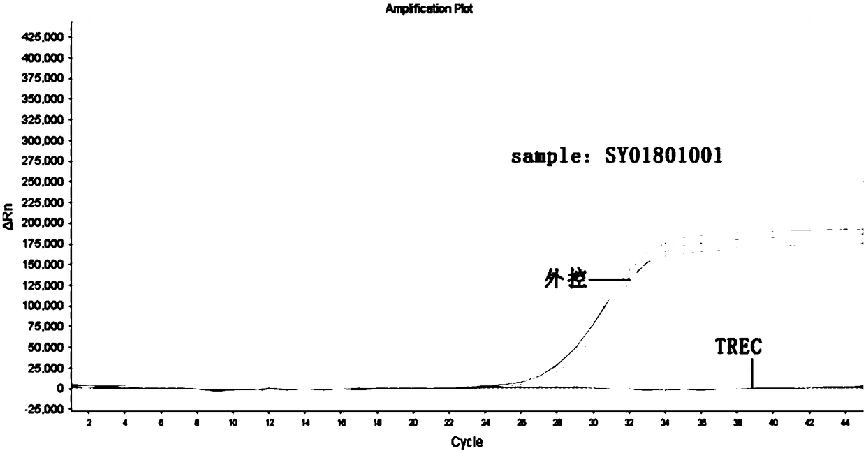 Primer, detection kit and detection method for screening SCID genetic diseases