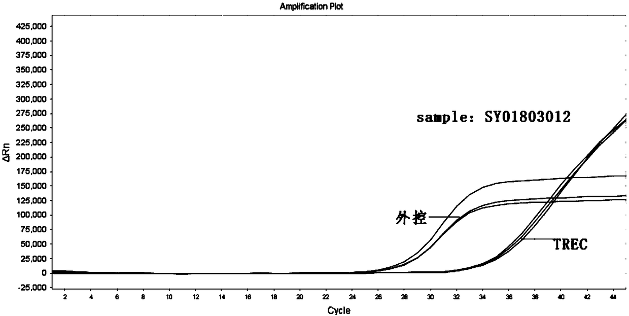 Primer, detection kit and detection method for screening SCID genetic diseases