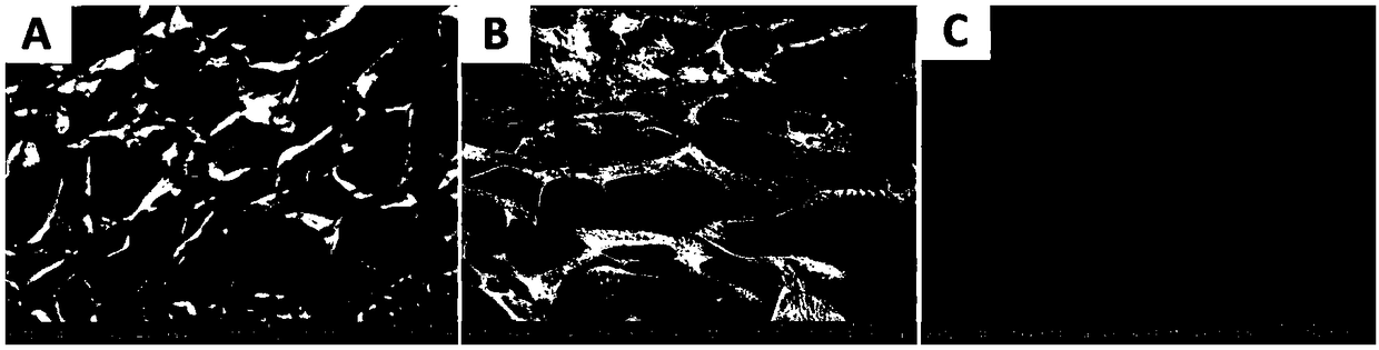 Preparation method of hydroxyethyl chitosan nano composite bone support material