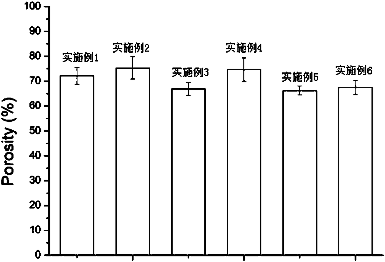 Preparation method of hydroxyethyl chitosan nano composite bone support material