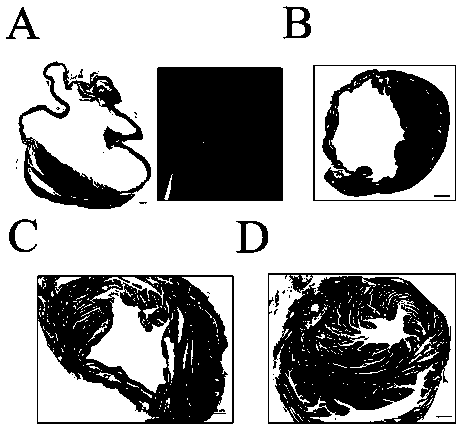 Construction method of mouse ventricular aneurysm model