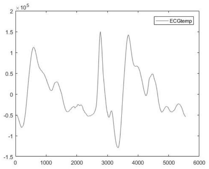 Online removal method for nuclear magnetic artifacts in synchronous EEG-fMRI data acquisition