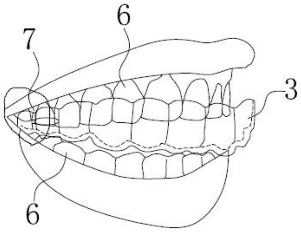 Auxiliary eruption guiding device for invisible appliance