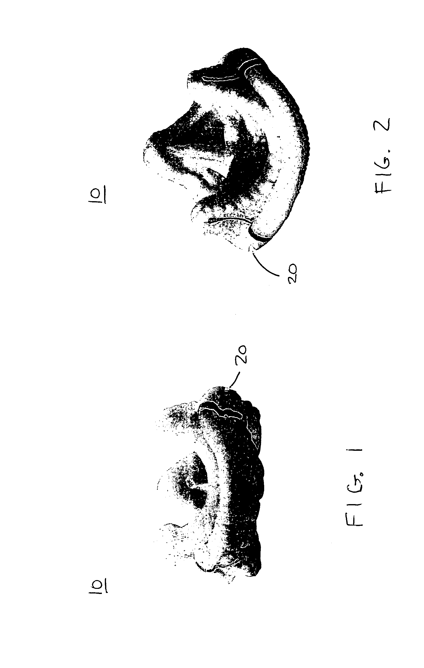 Prosthetic heart valves