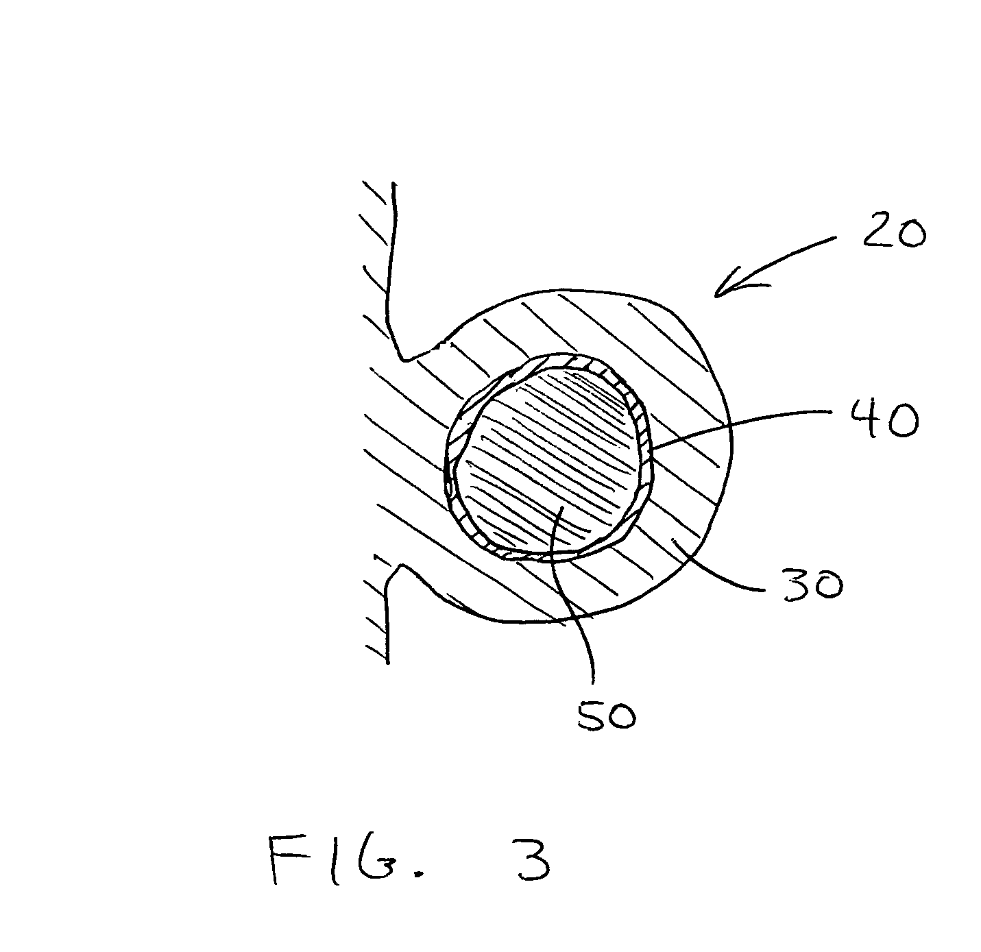 Prosthetic heart valves