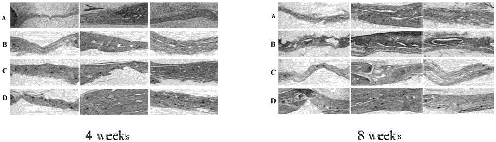 Fibrous internal and external mineralized collagen scaffold and preparation method thereof