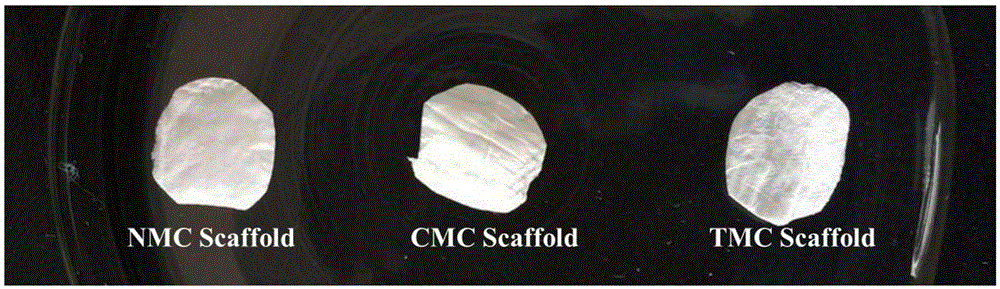 Fibrous internal and external mineralized collagen scaffold and preparation method thereof