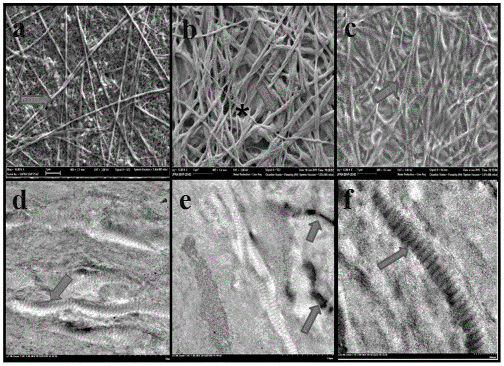 Fibrous internal and external mineralized collagen scaffold and preparation method thereof