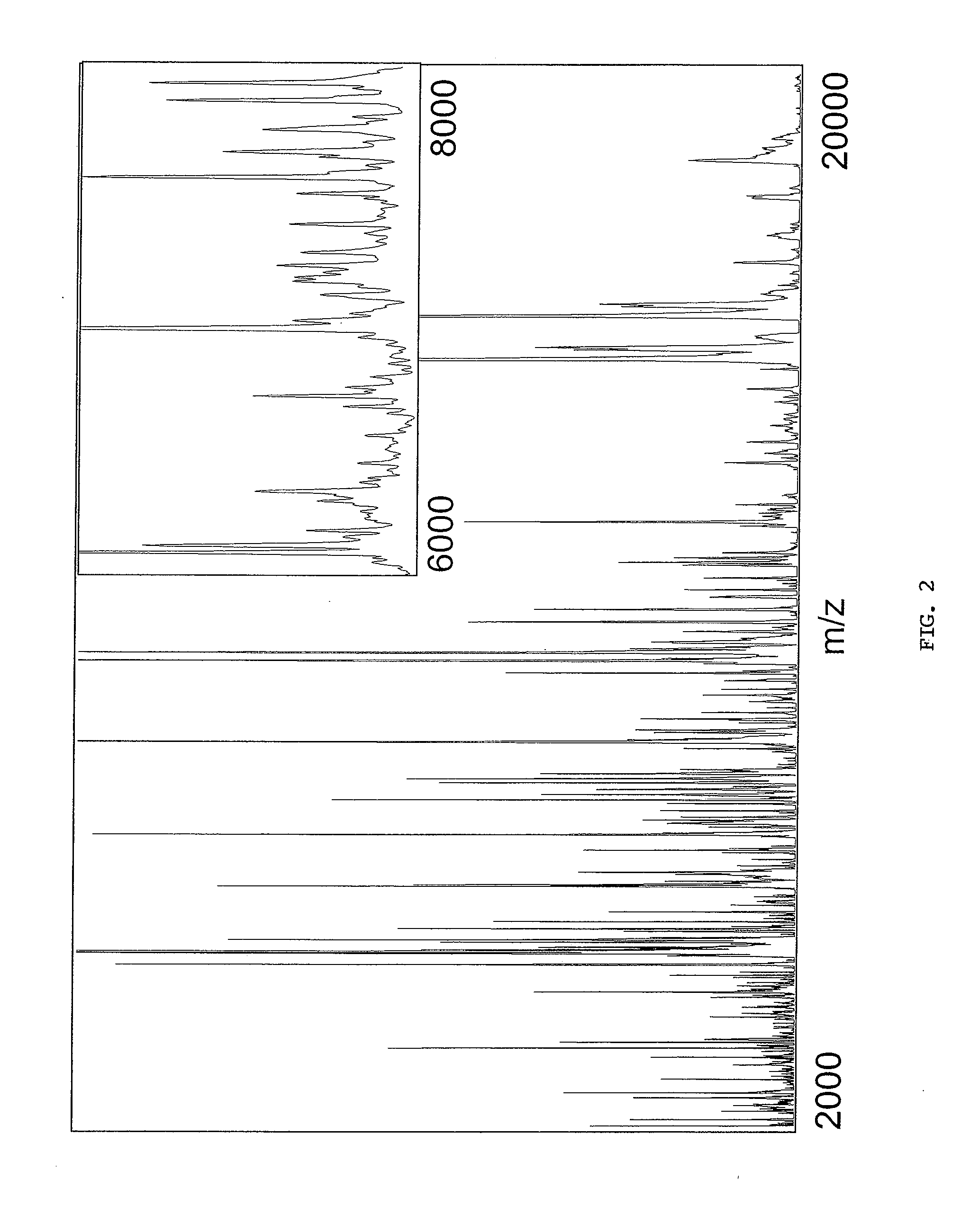 Diagnosing and Grading Gliomas Using a Proteomics Approach